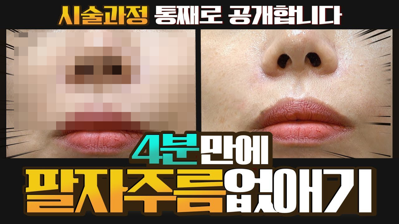 팔자주름 손쉽게 없애는 법 썸네일